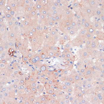 ZNRF3 Polyclonal Antibody
