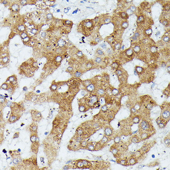 MAP3K1 Polyclonal Antibody