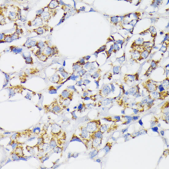 USP33 Polyclonal Antibody