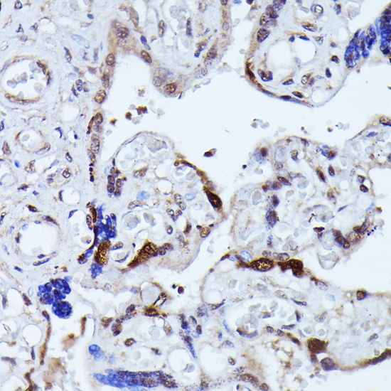 KIAA1429 Polyclonal Antibody