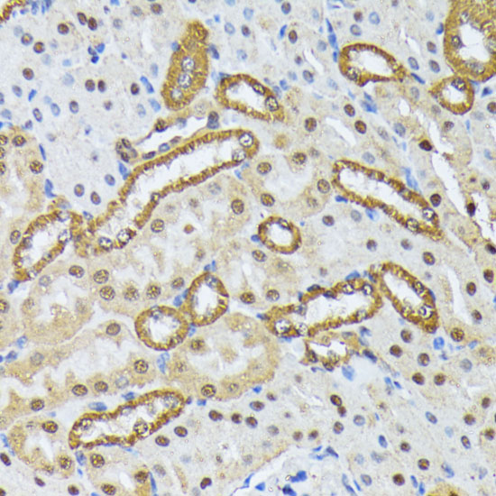 SMN2 Polyclonal Antibody