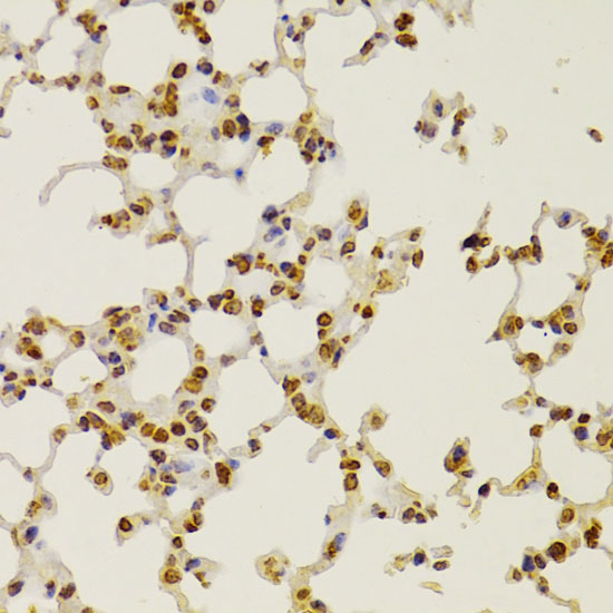 S100A4 antibody