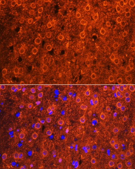 CDK6 antibody