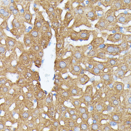 NUBP1 Polyclonal Antibody