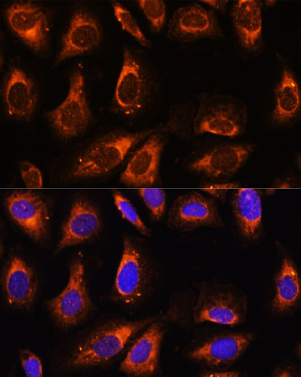 RPL26 Polyclonal Antibody