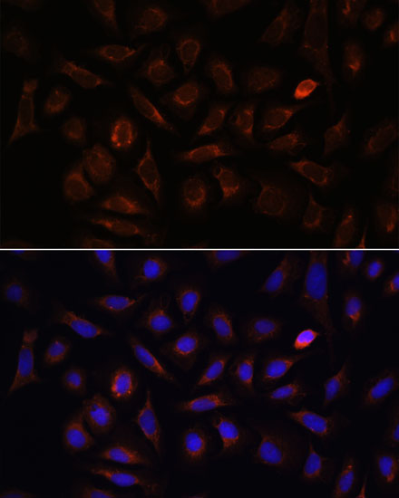 NRP1 Antibody