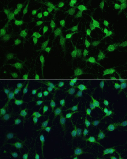 SMAD2/SMAD3 Polyclonal Antibody
