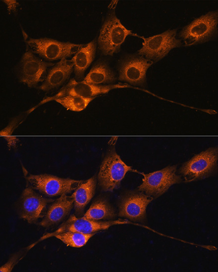 SERPING1 Antibody