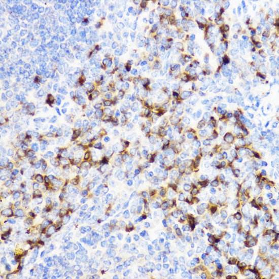 CHI3L1 antibody
