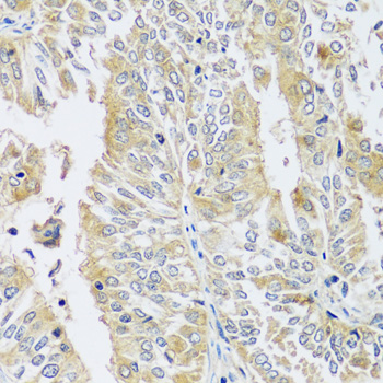 BLOC1S3 Polyclonal Antibody