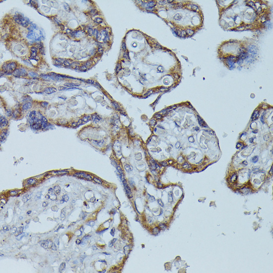 FCGR1B Polyclonal Antibody