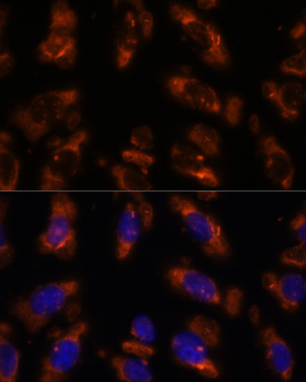 PDE6G Polyclonal Antibody