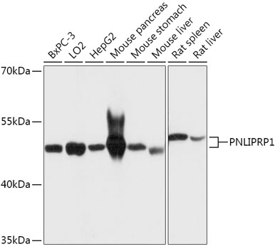 PNLIPRP1 Polyclonal Antibody