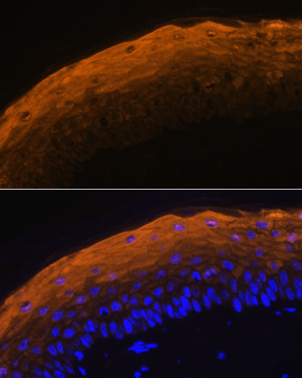 SPRR1A Polyclonal Antibody