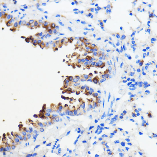 TMED3 Rabbit Polyclonal Antibody