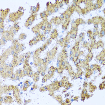 RAGE antibody