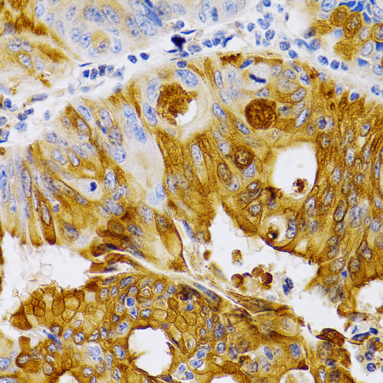 TFF1 antibody