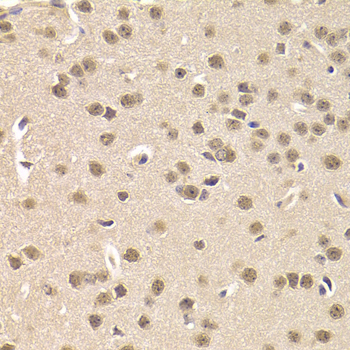CSNK1E antibody