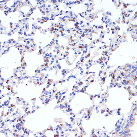 SFTPC Antibody