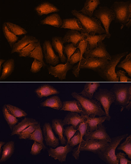 NCAPD2 Rabbit Polyclonal Antibody