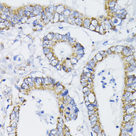 PDHA1 Antibody