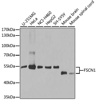 FSCN1 Polyclonal Antibody