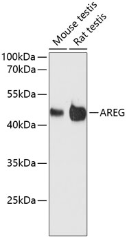 DBI Polyclonal Antibody