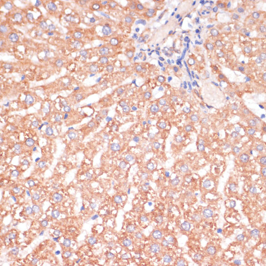 CHUK Antibody