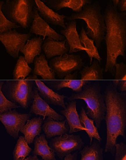 MALT1 antibody