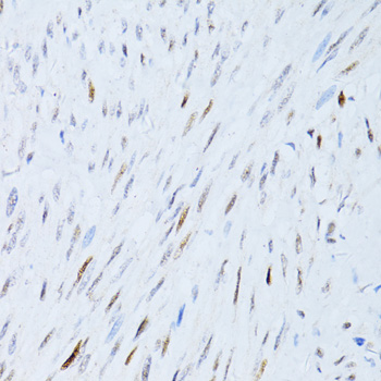 P21 Polyclonal Antibody