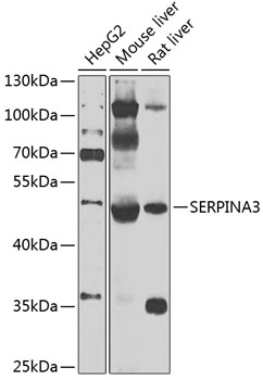 SERPINA3 Rabbit Polyclonal Antibody