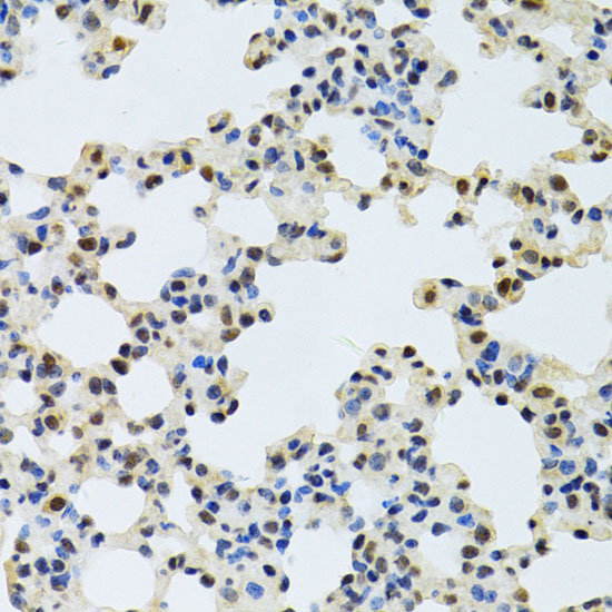NLK antibody
