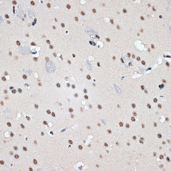 RBM17 Rabbit Polyclonal Antibody