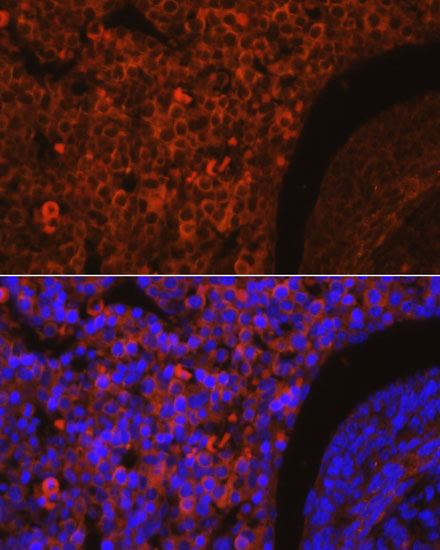 CXCR2 Rabbit Polyclonal Antibody