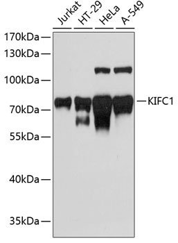 KIFC1 Rabbit Polyclonal Antibody