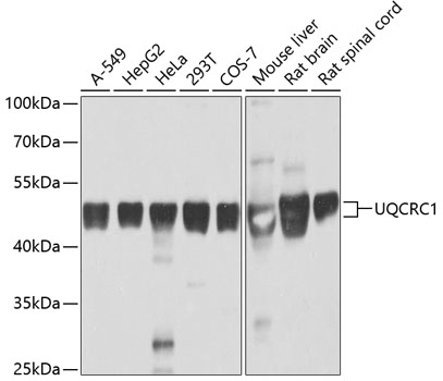 UQCRC1 Rabbit Polyclonal Antibody