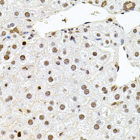 U2SURP Polyclonal Antibody