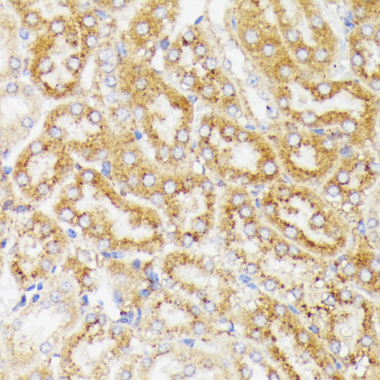 GALC Rabbit Polyclonal Antibody