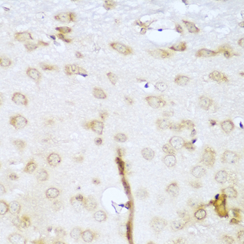 UBE2L3 Polyclonal Antibody