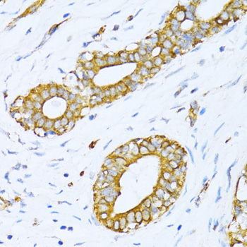 VARS Polyclonal Antibody