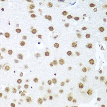BCAS2 Rabbit Polyclonal Antibody
