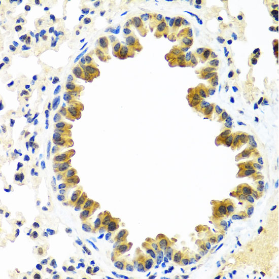 CRTAP Polyclonal Antibody