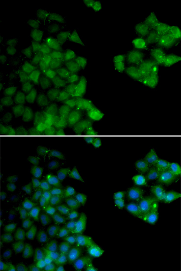 PSMB10 antibody