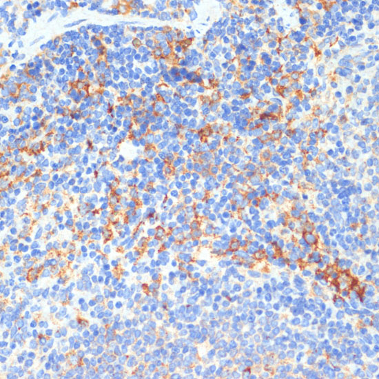 DDX3X Antibody