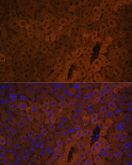 UGT1A1 Antibody