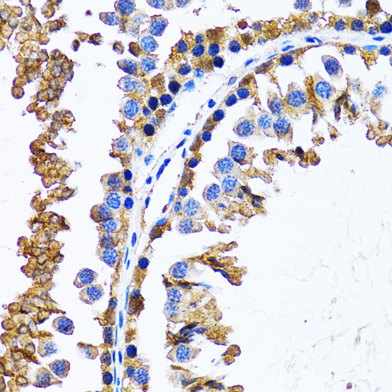 IMPA1 antibody