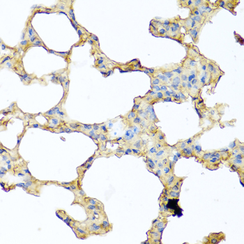 PIP antibody