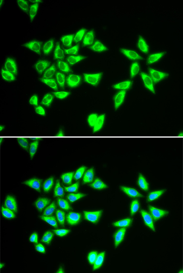 PTRH2 antibody