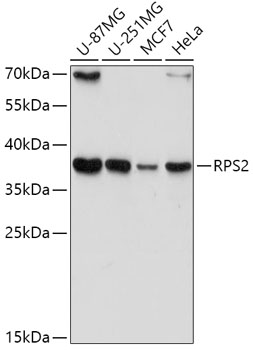 RPS2 Rabbit Polyclonal Antibody