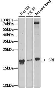 SRI Rabbit Polyclonal Antibody